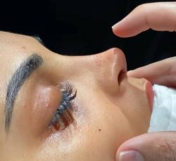 جراحی زیبایی بینی / پیکرتراشی/ عمل بینی/ لیزیک چشم