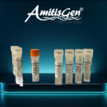 کیت تشخیص HIV