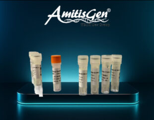 کیت تشخیص HIV