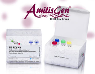 TB Detection & Quantitation Kit – Novin Gene